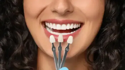 What is the Cost of a Dental Crown?